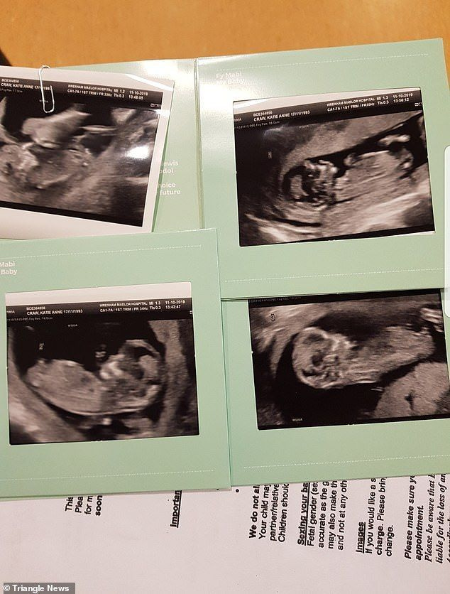 케이티와 롭은 코비드-19의 암울함 속에서 그들의 아기의 탄생이 한 줄기 햇살이었다고 말합니다. 사진은 그들의 스캔입니다.