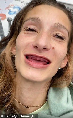 Μεταμόρφωση: Η Brittany Negler, 29, από τη Φιλαδέλφεια της Πενσυλβάνια, πήρε ένα χαμόγελο 30.000 δολαρίων από τον οδοντίατρο Dr. Kenny Wilstead αφού ένας άλλος οδοντίατρος της έβγαλε όλα τα δόντια της.