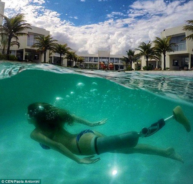 Le modèle publie des clichés de bikini sur Instagram sans cacher sa jambe prothétique afin d