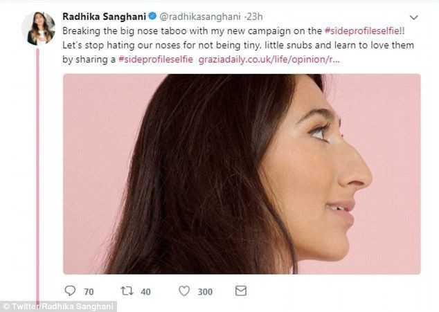 Londonist pärit Radhika Sanghani palus oma Twitteri jälgijatel oma külgprofiilidest pilte teha, et näidata oma nina, et murda suurema nina ilutabu.
